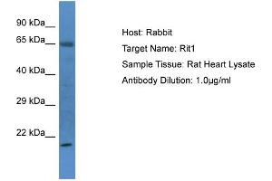 Host: Rabbit Target Name: Rit1 Sample Type: Rat Heart lysates Antibody Dilution: 1.