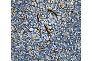 IHC analysis of EIF4A1 using anti-EIF4A1 antibody (ABIN7603125).