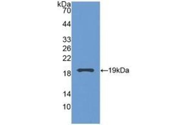 Grancalcin Antikörper  (AA 1-139)