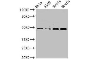 Western Blot Positive WB detected in: Hela whole cell lysate, A549 whole cell lysate, Rat brain tissue, Mouse brain tissue All lanes: GJA8 antibody at 2. (GJA8 Antikörper  (AA 286-432))
