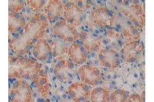 DAB staining on IHC-P; Samples: Mouse Kidney Tissue (PSMB9 Antikörper  (AA 22-219))