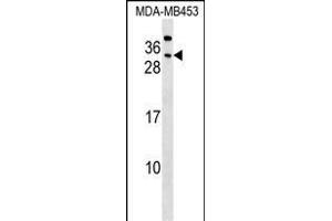 CEAC Antibody (Center) (ABIN1537760 and ABIN2848792) western blot analysis in MDA-M cell line lysates (35 μg/lane). (CEACAM7 Antikörper  (AA 112-140))