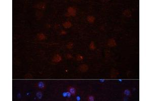 Immunofluorescence analysis of Rat brain using ASPN Polyclonal Antibody at dilution of 1:100 (40x lens). (Asporin Antikörper)
