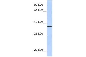 Western Blotting (WB) image for anti-Transmembrane Protein 200B (TMEM200B) antibody (ABIN2458847) (TMEM200B Antikörper)