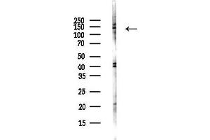 Western blot analysis of lysates from Hela cells(UV,30 min treatment), using PPIP5K2 Antibody at 1/1000 dilution.