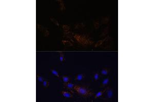 Immunofluorescence analysis of C6 cells using PSMB7 Polyclonal Antibody (ABIN7269594) at dilution of 1:100 (40x lens). (PSMB7 Antikörper  (AA 44-200))
