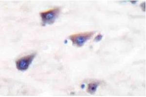 Image no. 2 for anti-Glutamate Receptor, Metabotropic 8 (GRM8) antibody (ABIN265441)
