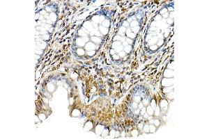 Immunohistochemistry of paraffin-embedded rat liver using Phospho--S473 Rabbit mAb (ABIN6135179, ABIN6135970, ABIN6135971 and ABIN7101880) at dilution of 1:100 (40x lens). (AKT1 Antikörper  (pSer473))