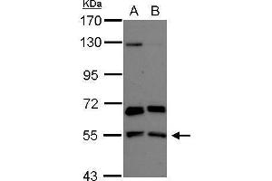 WB Image Sample (30 ug of whole cell lysate) A: NT2D1 B: U87-MG 7. (PACSIN2 Antikörper)