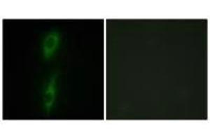 Immunofluorescence analysis of HeLa cells, using ACVL1 antibody. (ACVRL1 Antikörper)