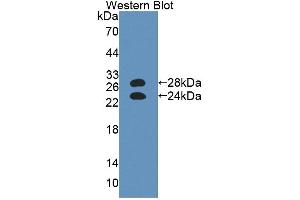 Western blot analysis of the recombinant protein. (ORM1 Antikörper  (AA 19-207))