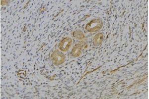 ABIN6277074 at 1/100 staining Human uterus tissue by IHC-P. (IL-13 Antikörper  (N-Term))