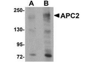 Western blot analysis of APC2 in HeLa cell lysate with AP30058PU-N APC2 antibody at (A) 1 and (B) 2 μg/ml.