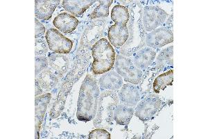 Immunohistochemistry of paraffin-embedded mouse kidney using FB2 Rabbit pAb (ABIN7267112) at dilution of 1:100 (40x lens). (FAM160B2 Antikörper)