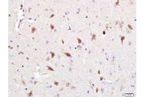Immunohistochemistry (Paraffin-embedded Sections) (IHC (p)) image for anti-Optineurin (OPTN) (AA 341-440) antibody (ABIN2178063)