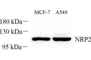 Western blot analysis of NRP2 (ABIN7074826) at dilution of 1: 300 (NRP2 Antikörper)