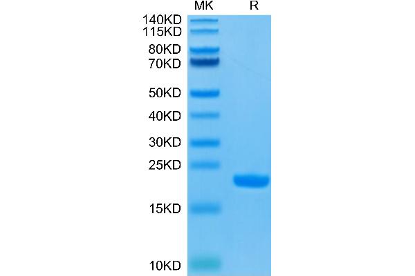 IL-1 beta Protein (AA 117-269) (His-Avi Tag)