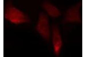 ABIN6276715 staining  Hela cells by IF/ICC. (ENOS Antikörper  (Internal Region))
