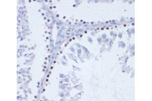 Immunohistochemistry of paraffin-embedded Rat testis using Phospho-γH2A. (gamma H2AX Antikörper  (pSer139))