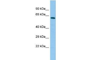 Host: Rabbit Target Name: YTHDF2 Sample Type: MCF7 Whole Cell lysates Antibody Dilution: 1. (YTHDF2 Antikörper  (C-Term))