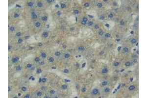 Immunohistochemistry (IHC) image for anti-PTK2 Protein tyrosine Kinase 2 (PTK2) (AA 798-1041) antibody (ABIN7439699)