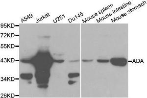 Western blot analysis of extracts of various cell lines, using ADA antibody. (ADA Antikörper  (AA 1-363))