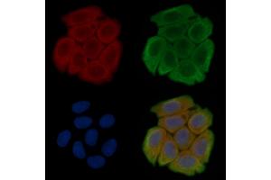 ABIN6257992 and ABIN6275831 staining Hela cells(45 min of heat-shock treatment) by IF/ICC. (TRAF2 Antikörper  (C-Term))
