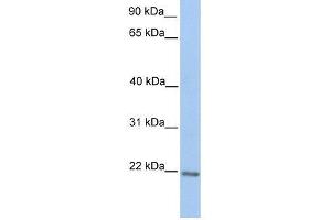 ZNF548 antibody used at 0. (ZNF548 Antikörper  (C-Term))