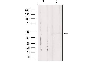 Western blot analysis of extracts from Mouse cancer, using CSTF1 Antibody. (CSTF1 Antikörper  (N-Term))