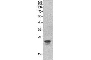Western Blot (WB) analysis of HeLa cells using SRY Polyclonal Antibody. (SRY Antikörper  (Internal Region))