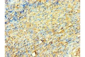 Immunohistochemistry (IHC) image for anti-X-Ray Repair Complementing Defective Repair in Chinese Hamster Cells 5 (Double-Strand-Break Rejoining) (XRCC5) (AA 543-732) antibody (ABIN7175904)