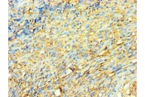 Immunohistochemistry of paraffin-embedded human tonsil tissue using ABIN7175904 at dilution of 1:100 (XRCC5 Antikörper  (AA 543-732))