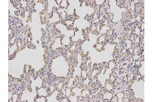 Immunohistochemistry (IHC) image for anti-Baculoviral IAP Repeat-Containing 5 (BIRC5) antibody (ABIN1875407) (Survivin Antikörper)