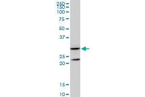GSTZ1 monoclonal antibody (M01), clone 1G12. (GSTZ1 Antikörper  (AA 109-216))