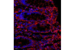Immunofluorescence (Paraffin-embedded Sections) (IF (p)) image for anti-Myosin Light Chain 6, Alkali, Smooth Muscle and Non Muscle (MYL6) antibody (ABIN7074734)