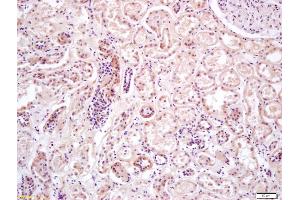 Formalin-fixed and paraffin embedded human kidney labeled with Anti-PRKAA2/AMPK alpha 2 Polyclonal Antibody, Unconjugated (ABIN680458) at 1:200 followed by conjugation to the secondary antibody and DAB staining (PRKAA2 Antikörper  (AA 351-450))