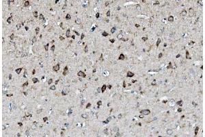 IHC analysis of MEK2/MAP2K2 using anti-MEK2/MAP2K2 antibody (ABIN7599357). (MEK2 Antikörper  (AA 1-400))