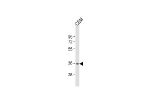 Anti-RN Antibody (Center) at 1:2000 dilution + CEM whole cell lysate Lysates/proteins at 20 μg per lane. (RNF126 Antikörper  (AA 84-115))