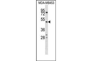 Western Blotting (WB) image for anti-serpin Peptidase Inhibitor, Clade A (Alpha-1 Antiproteinase, Antitrypsin), Member 5 (SERPINA5) (AA 4-33), (N-Term) antibody (ABIN954741)