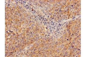 Immunohistochemistry (IHC) image for anti-Adenosine Deaminase (ADA) (AA 157-343) antibody (ABIN7143283)