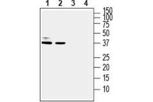Western blot analysis of human U-87 MG glioblastoma cell line lysate (lanes 1 and 3) and human HT-29 colorectal adenocarcinoma cell line lysate (lanes 2 and 4): - 1, 2. (DARPP32 Antikörper  (C-Term, Intracellular))