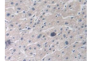 Immunohistochemistry (IHC) image for anti-Myxovirus Resistance Protein 1 (MX1) (AA 80-342) antibody (ABIN7430081)