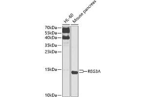 Western blot analysis of extracts of various cell lines, using REG3A antibody (ABIN6132545, ABIN6146855, ABIN6146856 and ABIN6216122) at 1:1000 dilution. (REG3A Antikörper  (AA 27-175))