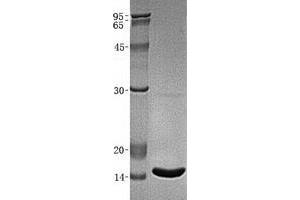 Validation with Western Blot (beta-2 Microglobulin Protein)