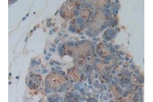 Immunohistochemistry (IHC) image for anti-Cathepsin L1 (CTSL1) (AA 114-288) antibody (ABIN7431587)