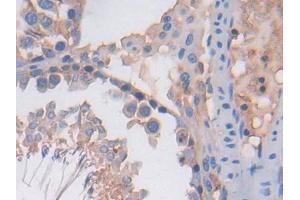 DAB staining on IHC-P; Samples: Rat Testis Tissue (PF4 Antikörper  (AA 30-105))
