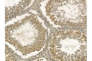 LCHN Mouse Monoclonal Antibody at 1/100 staining rat testis tissue by IHC-P.