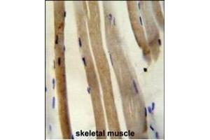 CS Antibody (N-term) (ABIN652074 and ABIN2840538) immunohistochemistry analysis in formalin fixed and paraffin embedded human skeletal muscle followed by peroxidase conjugation of the secondary antibody and DAB staining. (CS (AA 27-55), (N-Term) Antikörper)