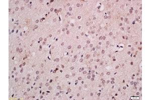 Formalin-fixed and paraffin embedded rat brain labeled with Anti-FOXB1 Polyclonal Antibody, Unconjugated  at 1:200 followed by conjugation to the secondary antibody and DAB staining.
