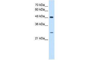 WB Suggested Anti-SH3BGR Antibody Titration:  0. (SH3BGR Antikörper  (N-Term))
